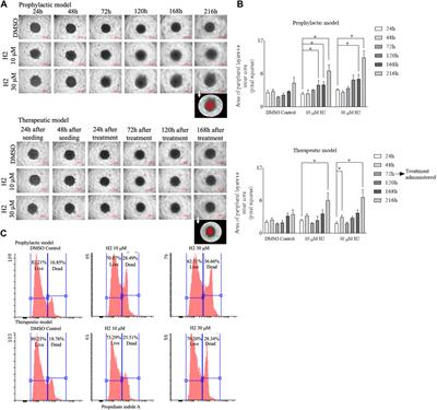 Targeting hexokinase 2 for oral cancer therapy: structure-based design and validation of lead compounds